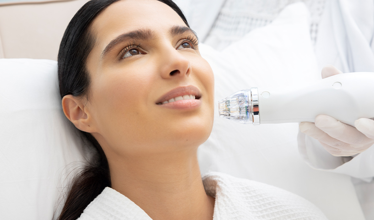 SECRET FRACTIONAL RF MICRONEEDLING
