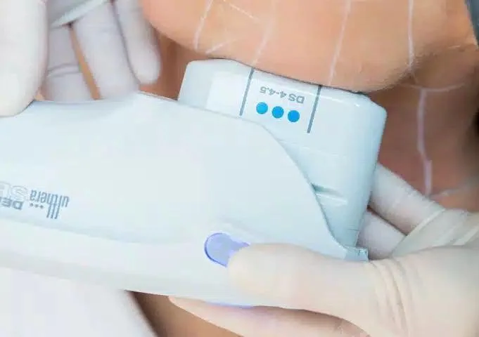 ultherapy dubai